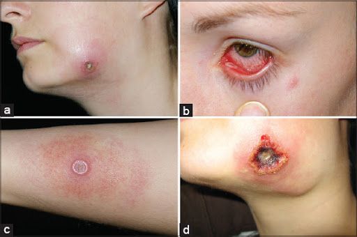 Cowpox, catbox, virus, disease, health